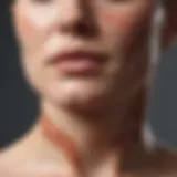 Illustration depicting the skin layers affected by psoriasis