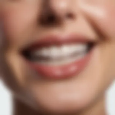 Close-up of a bright smile showcasing whitened teeth